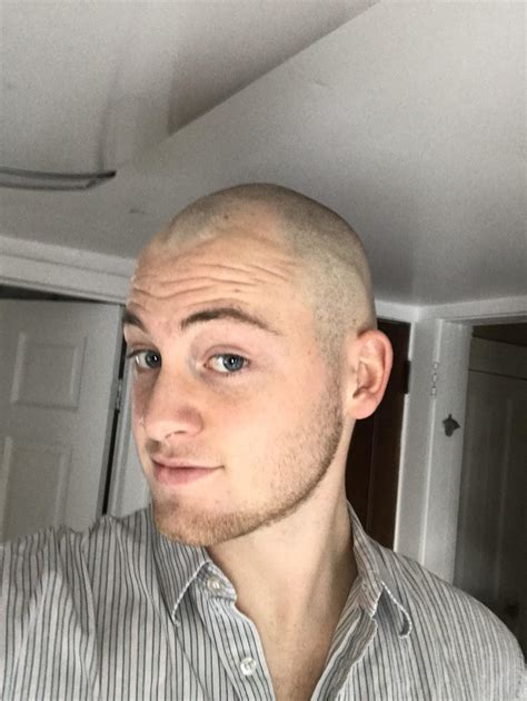 reddit bald|balding at 20 reddit.